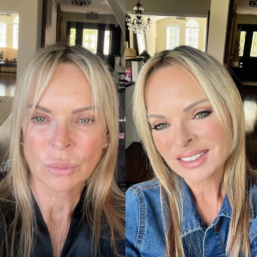 Beauty (26)